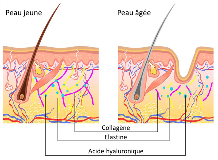 évolution de la structure de la peau avec l'âge